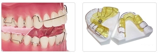 orthodontic treatment-braces-Functional Appliance-Orthodontist-cool牙